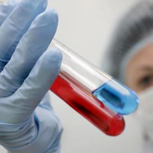 Гинеколог заразившая трех пациенток ВИЧ попала под амнистию