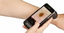 Рак кожи распознает iPhone
