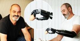 В США одобрили DEKA Arm System – самый совершенный протез руки
