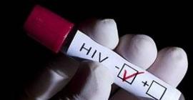 Ученые научились очищать клетки от ВИЧ