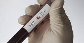 Зафиксирован 1-ый случай полного излечения от ВИЧ