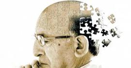 Американские специалисты рассказали о первых признаках болезни Альцгеймера