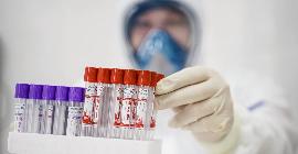 Китайские ученые опубликовали результаты первого в мире эксперимента на животных против коронавируса