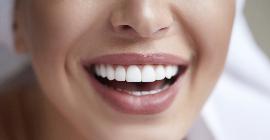 Голливуд снова в тренде: как выбрать оптимальный оттенок зубов?