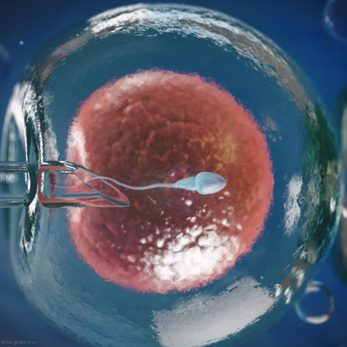 перенос спермы в матку фото 113