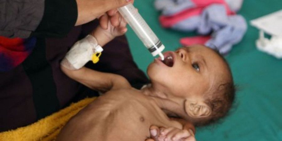 85 тысяч детей умерло от голода в Йемене