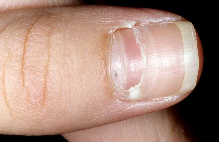 ногти в форме ложки