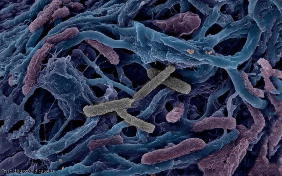 бактерии кишечные 