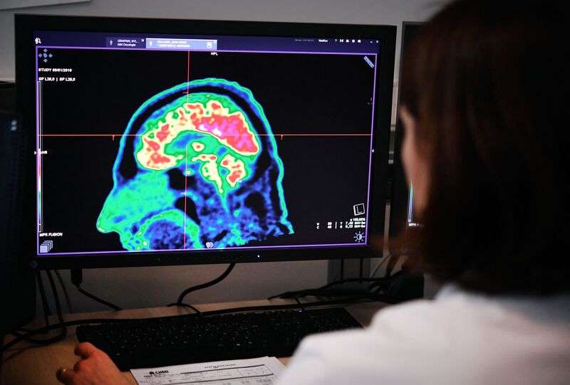 сканирование человеческого мозга